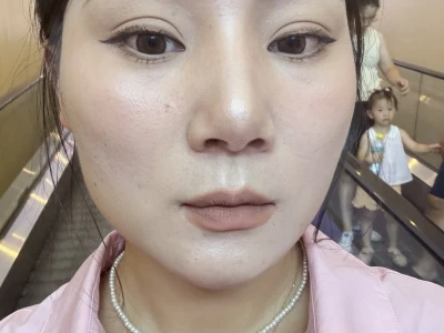 打了瘦脸针后悔了