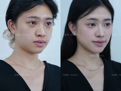 找对微调思路 素颜也可以躺赢
