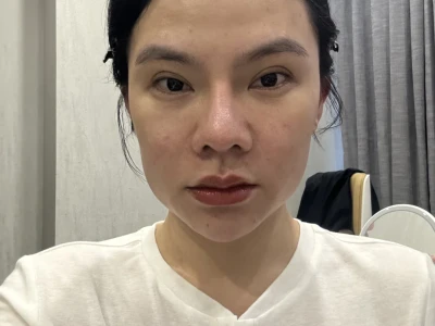 馒化修复算成功了吗??