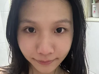 热玛吉一个半月无滤镜原相机对比