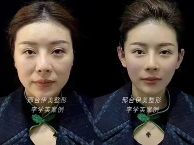 美的惊艳