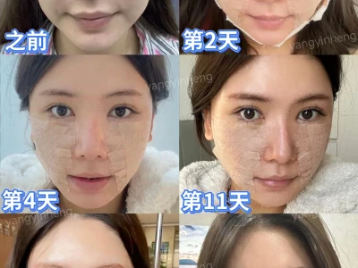 从馒化垮脸→紧致提升❗这才是有效变美思路