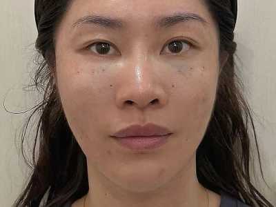 調了,效果明显吗?