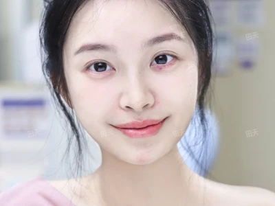 方圆脸毕业!自然妈生上镜也能赢