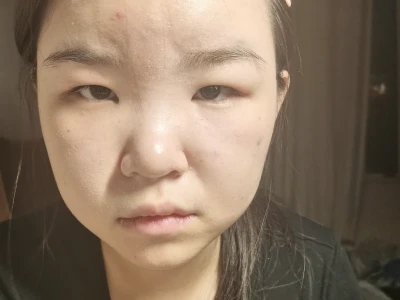 17岁脸垮成这样还有救吗