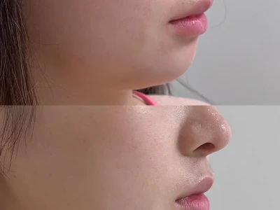 下颌线清晰|下颌缘|轮廓|骨相