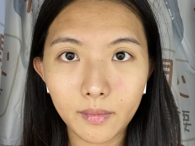 想做医美求建议……