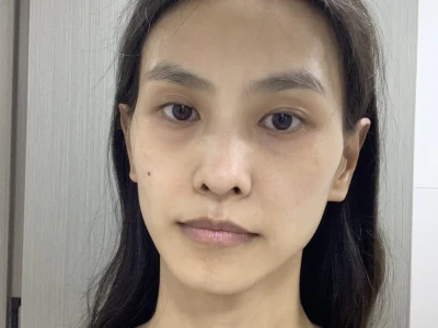 真实的素颜状态