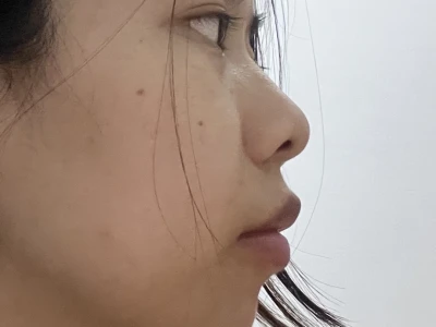 两年的侧面变化图~