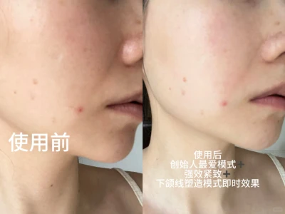 入手ZIIP美容仪 一整套护肤流程(干货版