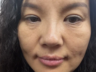 40岁才开始护肤应该不晚吧?