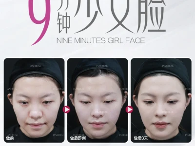 少女脸