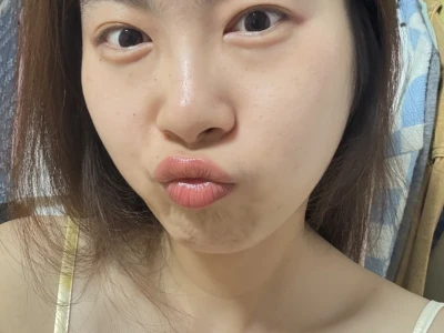 好喜欢今天的皮肤状态哎