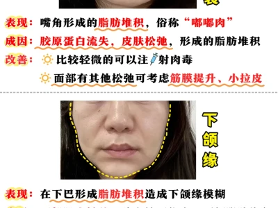 医美大白说真话|衰老跨脸表现自测❗