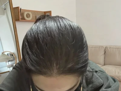 雄脱女，打卡一年，发量回归
