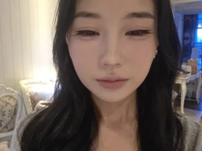 瘦脸针后续来啦!