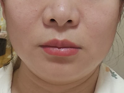 35岁纯素人做超声炮一个月体验