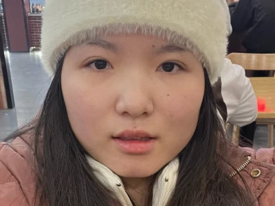 大连瘦脸针100u保妥适打三个部位