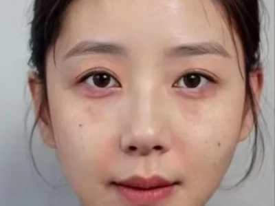 30+突然get少女肌