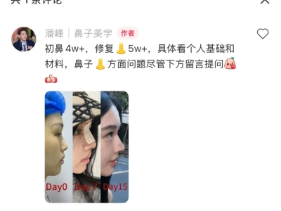 为什么现在都没纯天然的美女了