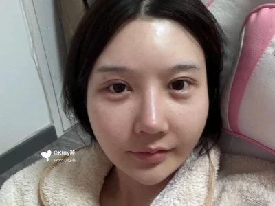 听劝 现在还要动哪里变美女
