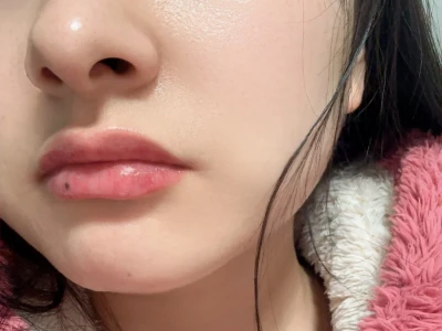 打了水光感觉皮肤状态真好啊啊啊啊