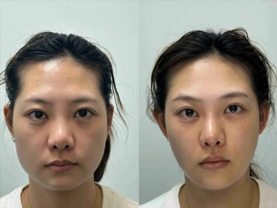 自然气质焕发,展现幼态脸之美