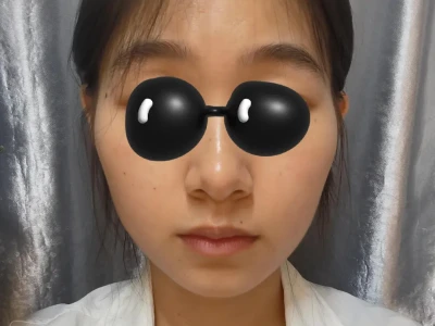 第①次 瘦脸