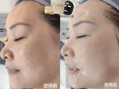 三次让你脸型改变皮肤细腻