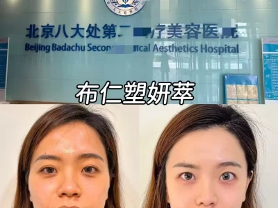 去北京八大处看了我的菱形脸