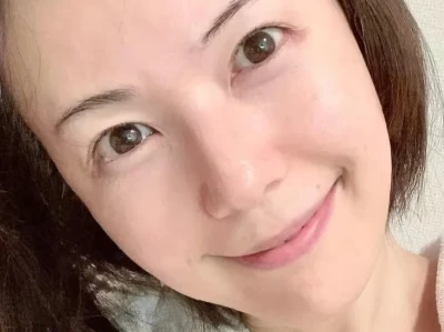 43岁阿姨跟风来打轮廓提升了