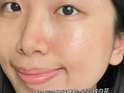 变美后烂脸?15天换皮实录