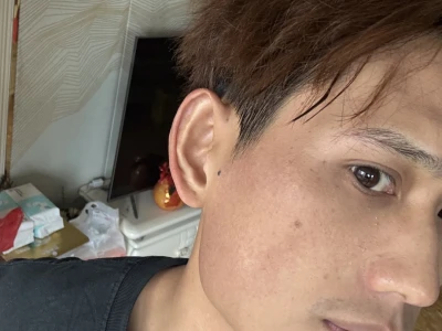 我弟祛斑美白大战的第三天❗