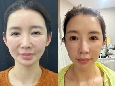 反馈，变美了