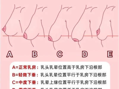 快来看看你的🐻真的“下垂”了吗?