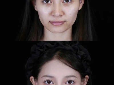 揭秘幼态脸！这些特征与变美秘籍必看✨
