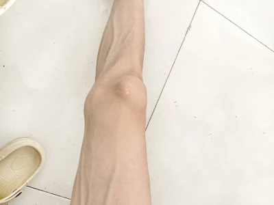 162 36kg｜ed，迷恋瘦是少女时代的淤青