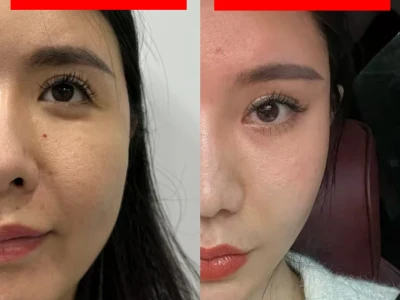 馒化脸vs轻薄脸,解脱就是这么简答