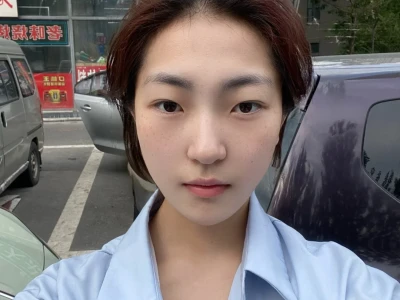 去M后脸蛋饱满，脸小了10斤？