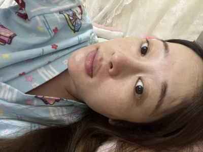 怎么与这一脸的斑和解