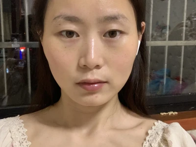 压颧骨的第一天