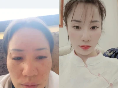 没整容半个月打造这个样子。
