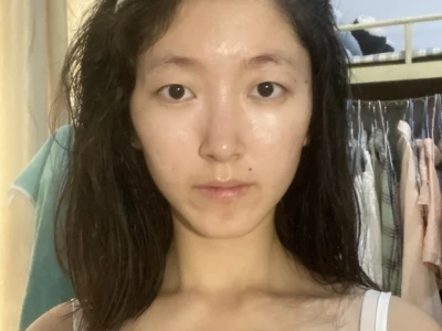 痘肌的痛我懂!左滑看我逆袭