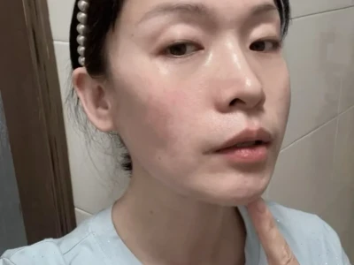 50岁阿姨垮脸之法令纹消失篇！