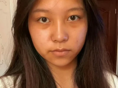 妈生黑皮38年,还有救吗?