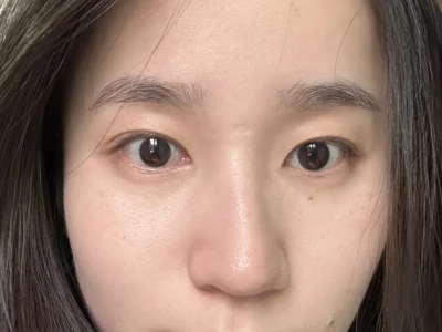 最近皮肤状态太棒了