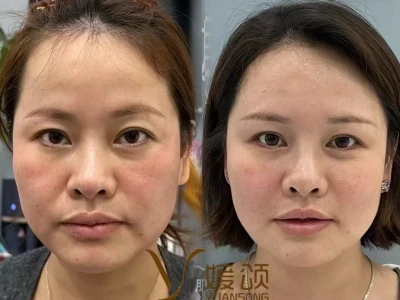 Do脸抗衰不走弯路