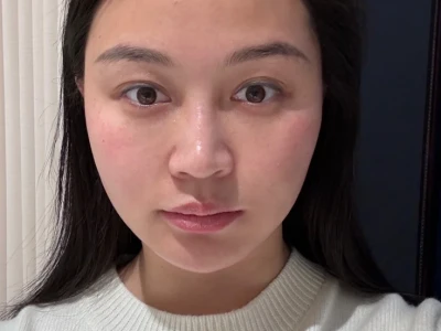 这张脸看着正常了~