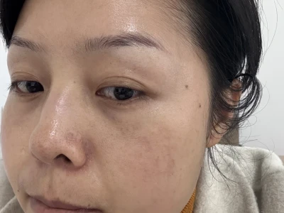 35岁,素颜,养肤一年多,真的可以改变面相!