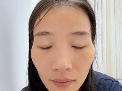 我这个脸型有没有救啊救命